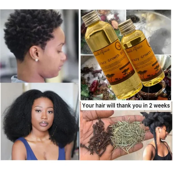 Africa Crazy Growth Oil Only 10-30 ml GROW YOUR HAIR FASTER LONGER IN TWO WEEKS