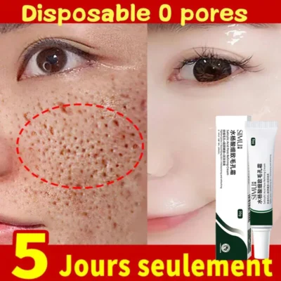 Salicylic-Acid-Pores-Shrink-Refining-Cream-Treatments-Large-Open-Pore-Remove-Black-Dots-Blackhead-Acne-Marks-5